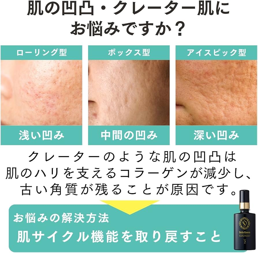 Amazon.co.jp: ドクターRe9 クレーター肌ケア用 ベルクイーン